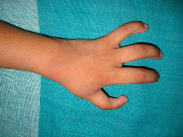 Case 1   Post operation