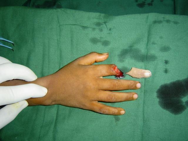 1. case Pre operation