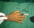 1. case Pre operation