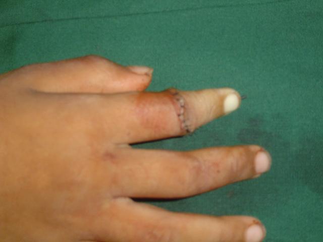 1. post operation
