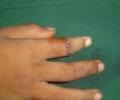 1. post operation