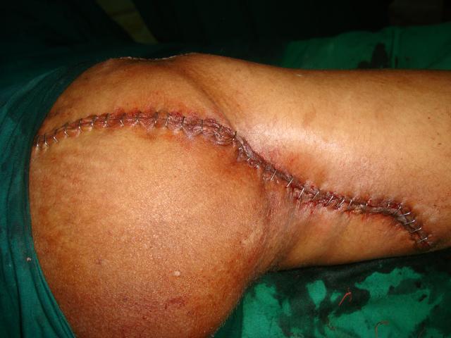 Case 2 Post operation