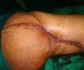 Case 2 Post operation