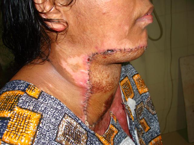Case 3   Post operation