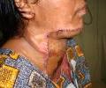 Case 3   Post operation