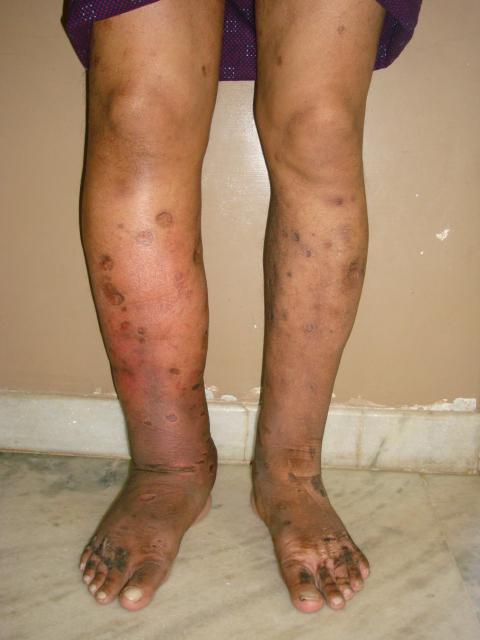 Case -1 Post operation
