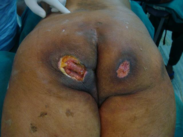 Case -1 Pre operation