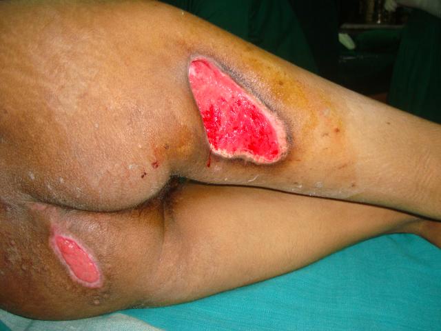 Case 2 picture Pre operation