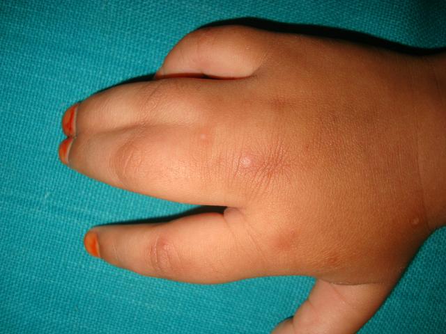 1. Pre Op
