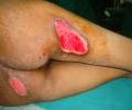 Case 2 picture Pre operation