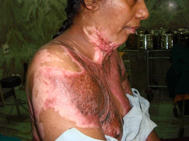 Case -3 Pre operation