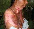 Case -3 Pre operation