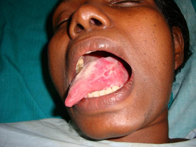 4th picture Pre operation